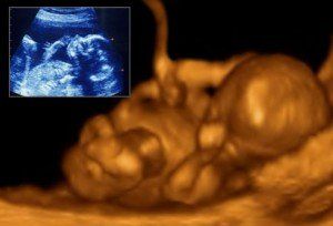 embryo in ultrasound new life adoptions